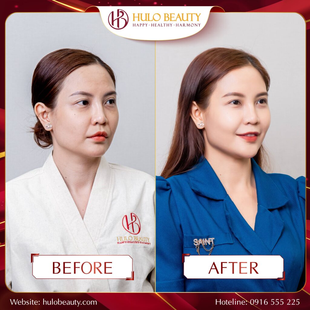 HULO BEAUTY 
