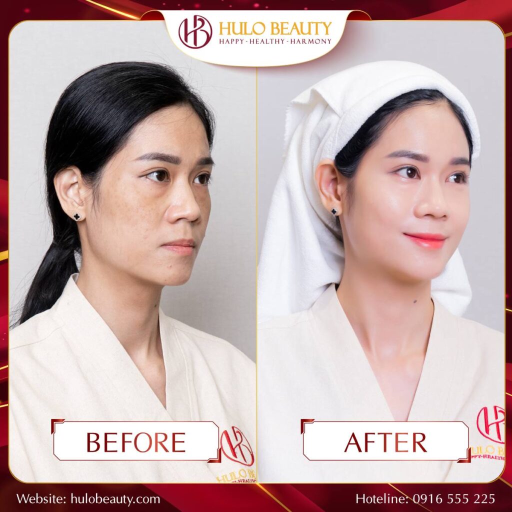 HULO BEAUTY 