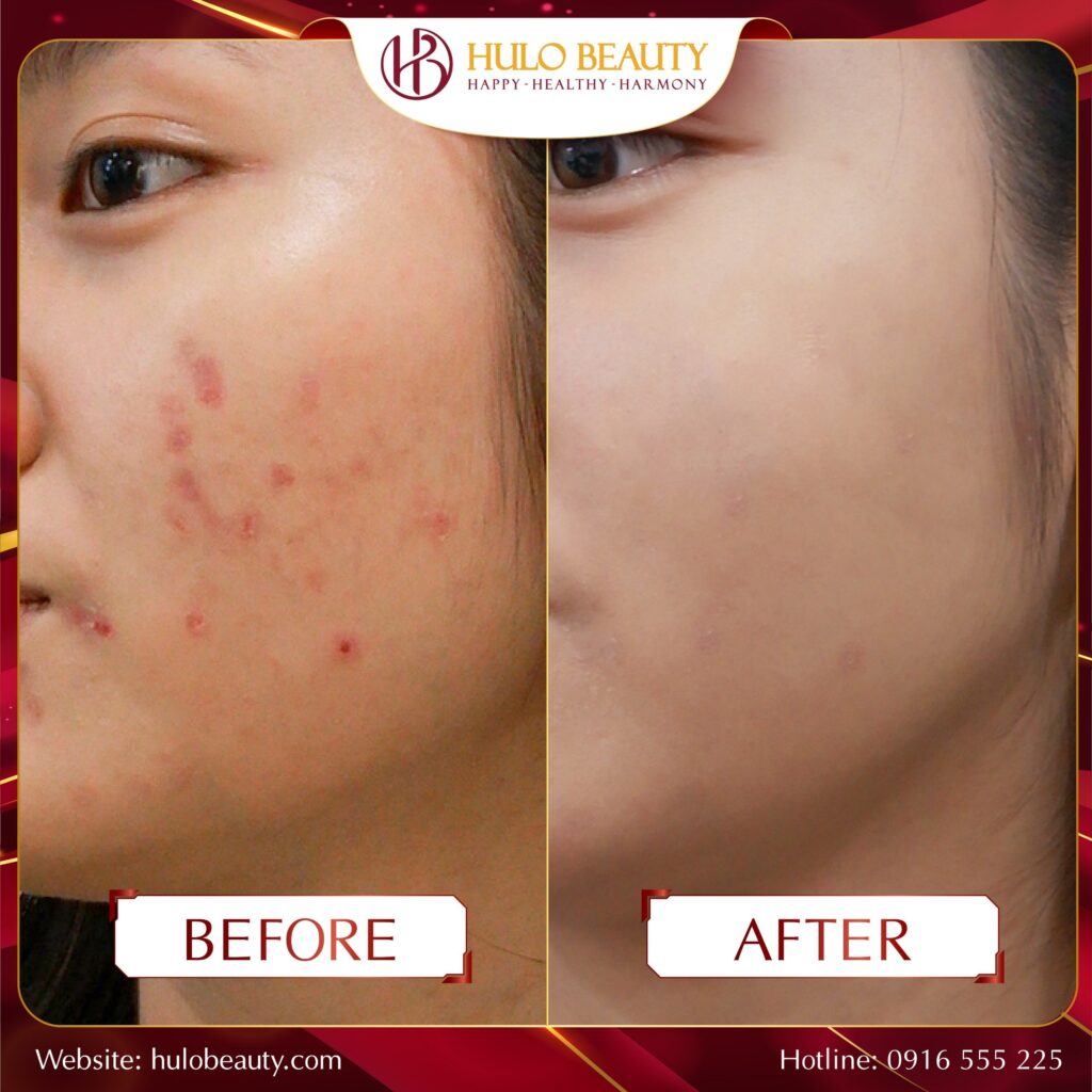 HULO BEAUTY 