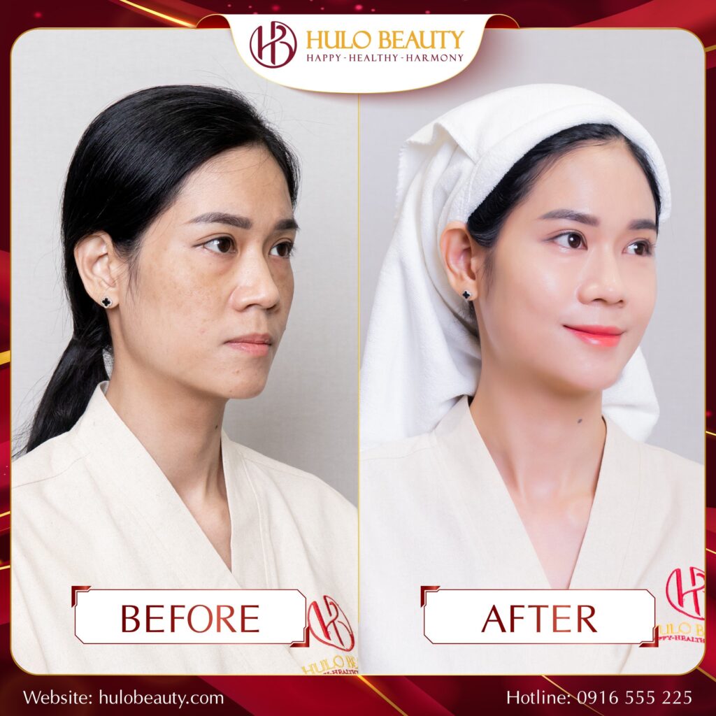 HULO BEAUTY 