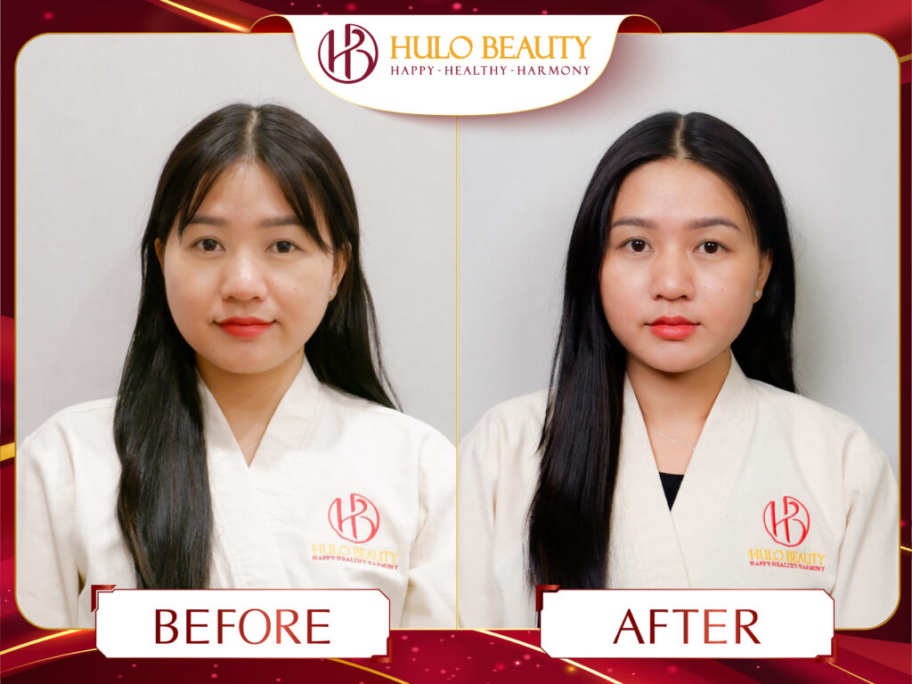 HULO BEAUTY 