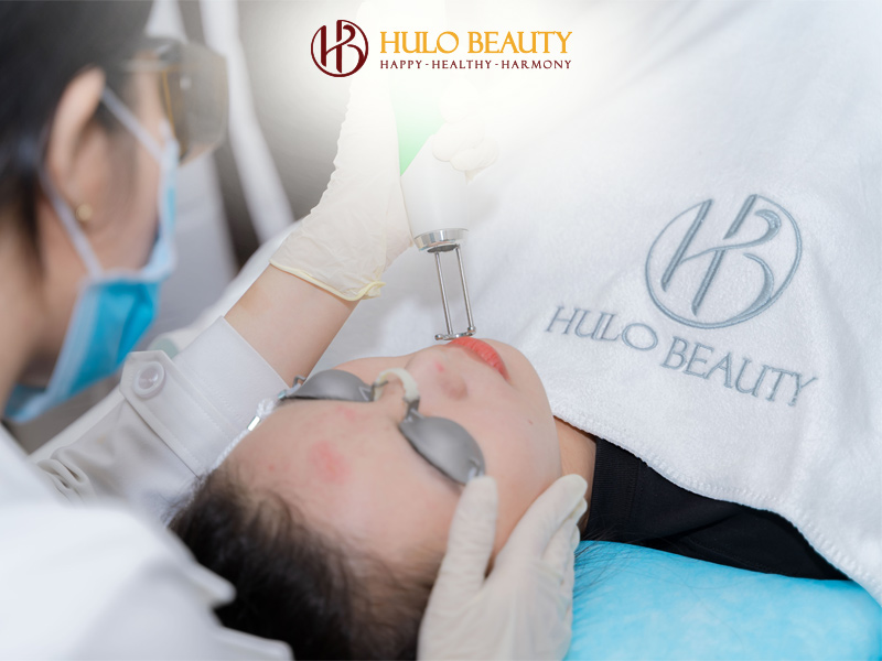 HULO BEAUTY 