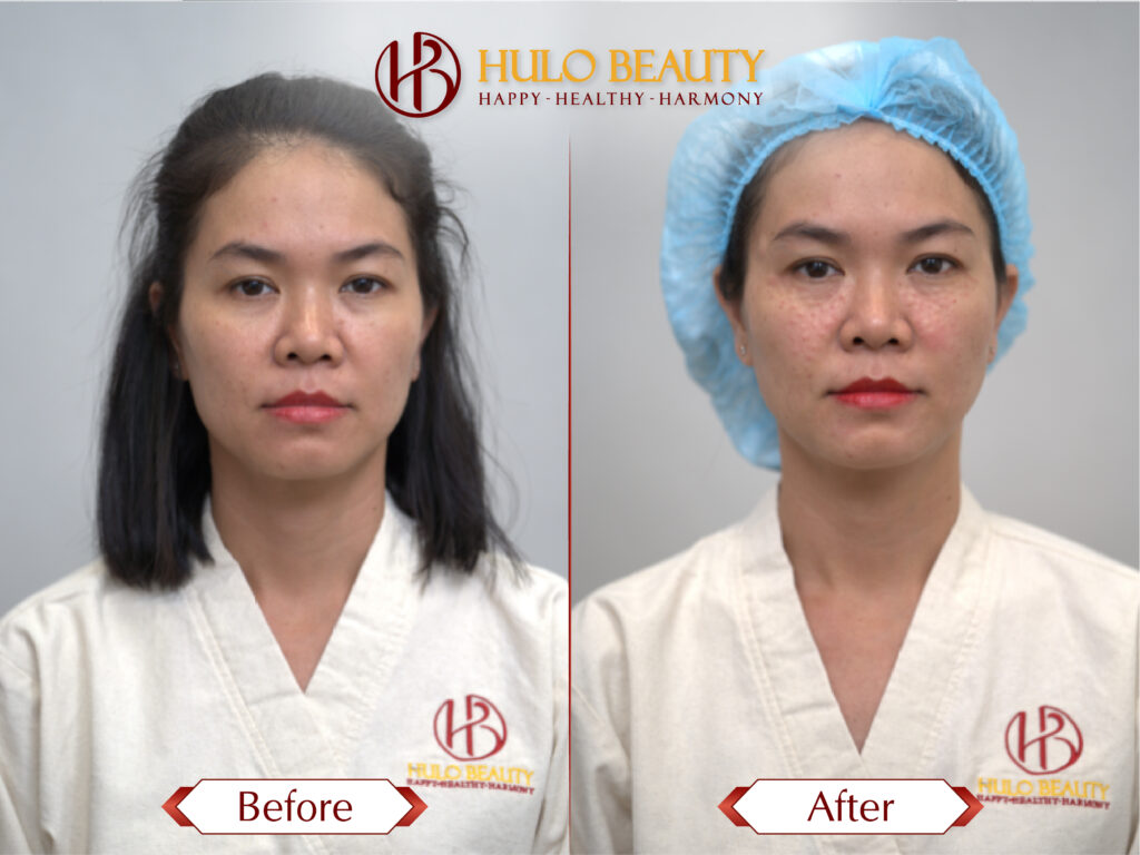 HULO BEAUTY 