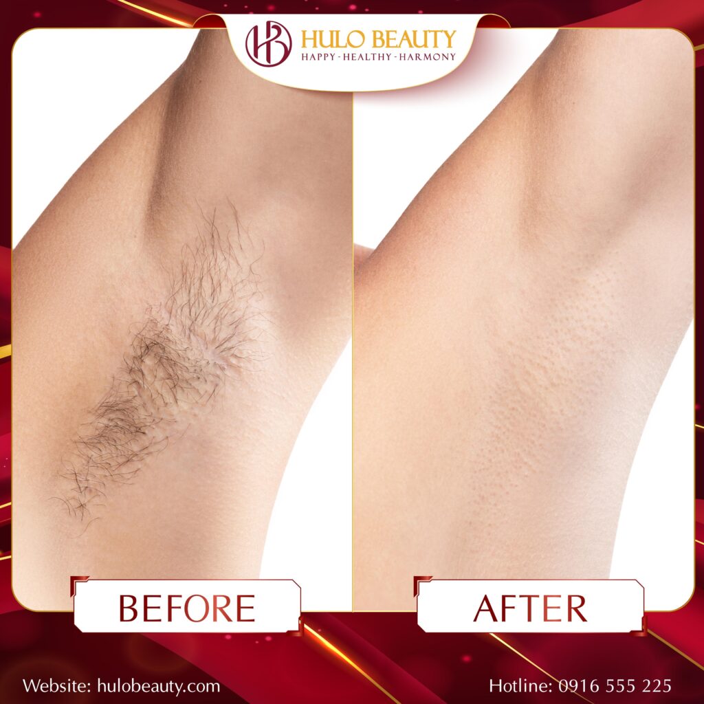 HULO BEAUTY 
