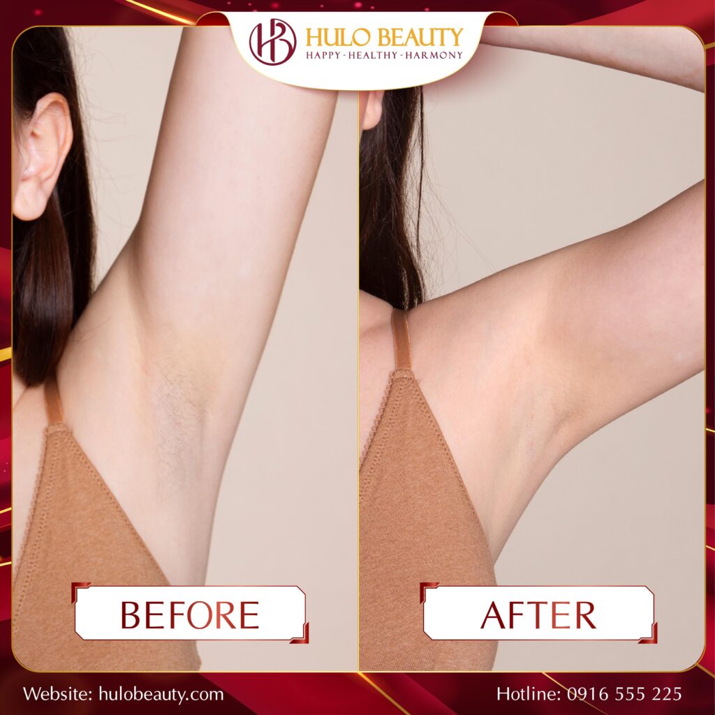 HULO BEAUTY 