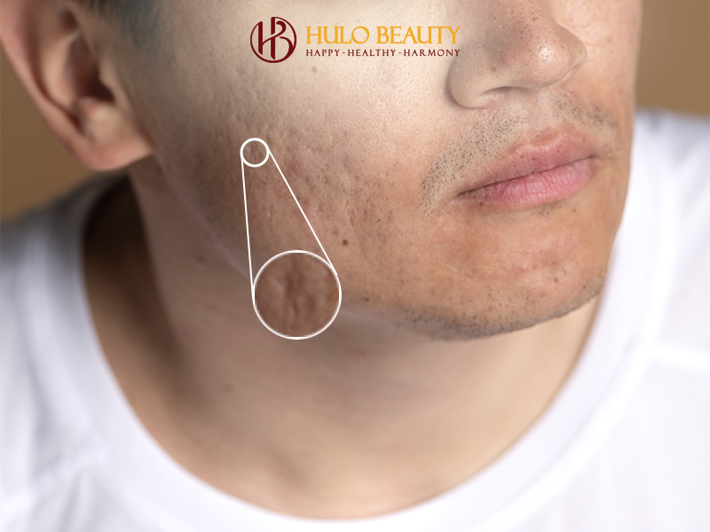 HULO BEAUTY 