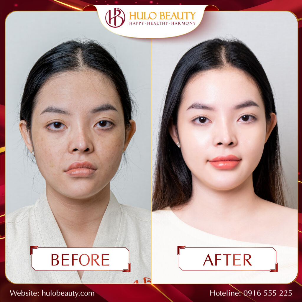 HULO BEAUTY 