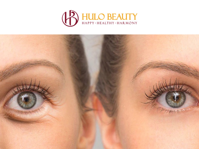 HULO BEAUTY 