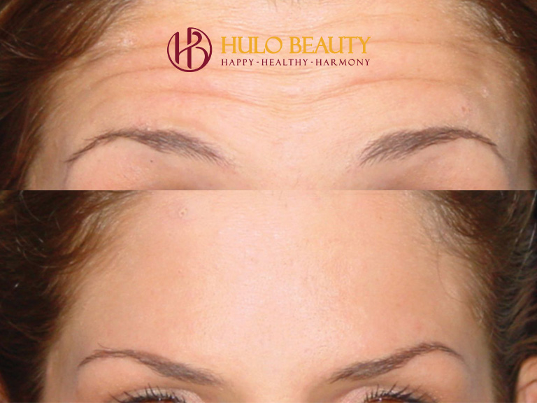 HULO BEAUTY 