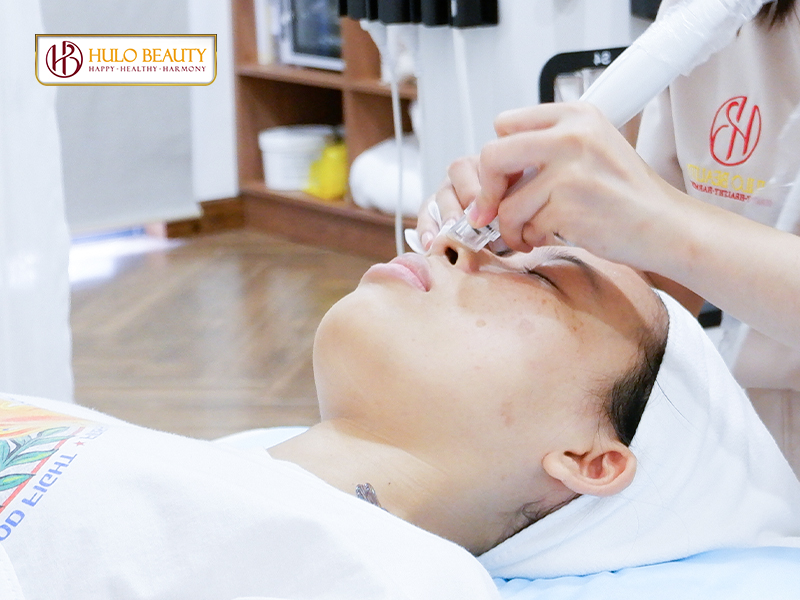 Bước 4: Aqua Peel