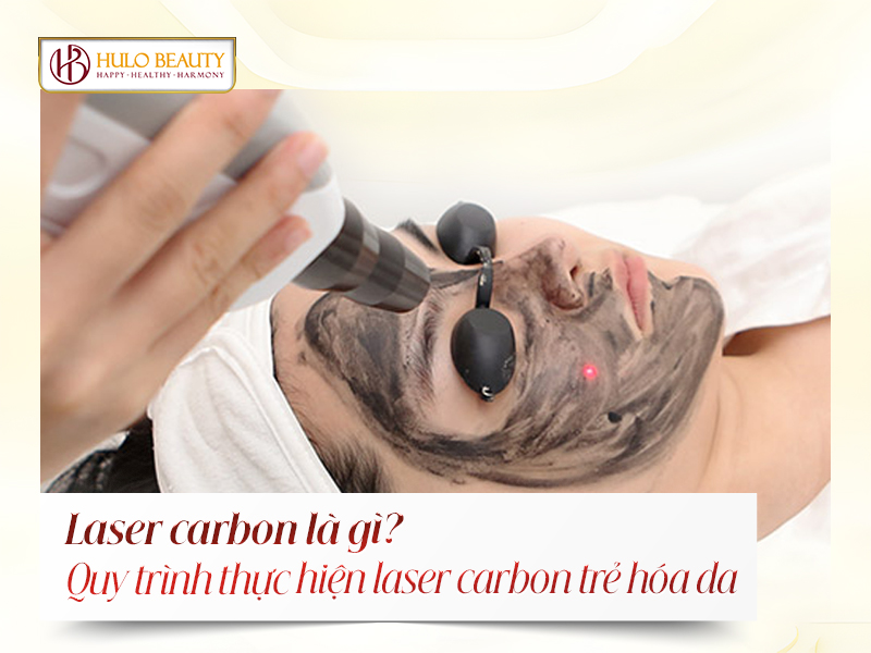 laser carbon là gì