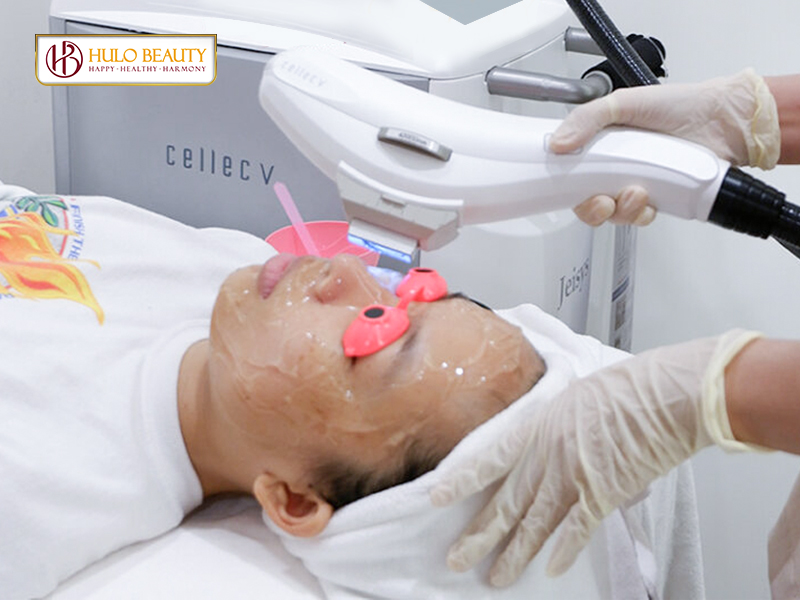 Bước 4: Chiếu IPL