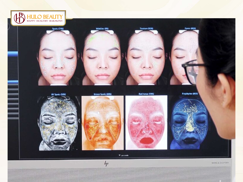 Bước 1: Bác sĩ thăm khám, soi da và tư vấn