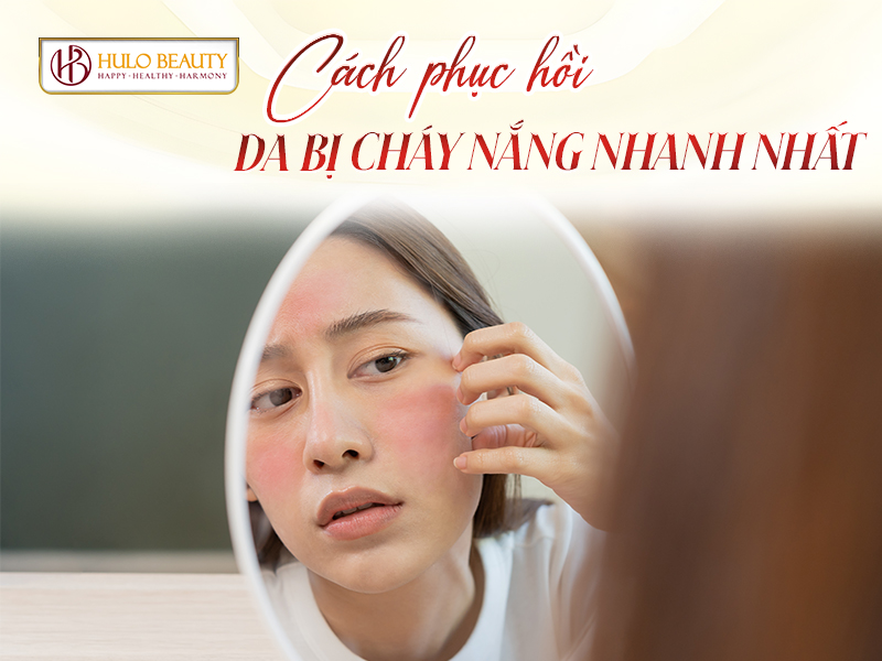 cách phục hồi da bị cháy nắng nhanh nhất